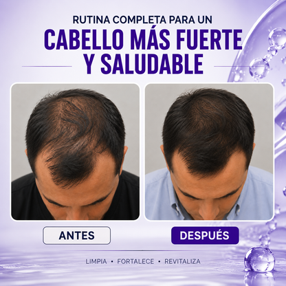 Minoxidil y Biotina · Shampoo + Acondicionador Fortalecedor · 300ml